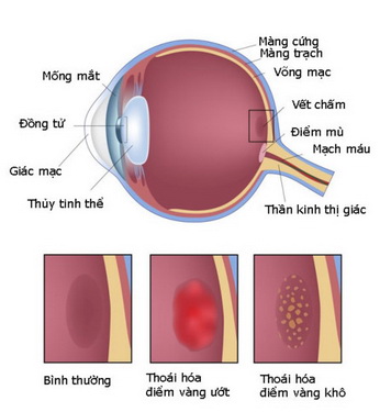 nhung yeu to tang nguy co thoai hoa diem vang