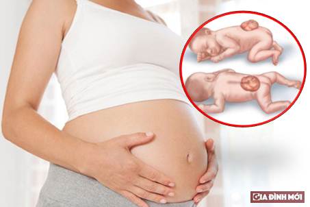 lam nhung dieu nay khi mang thai de mat con va sinh con di tat