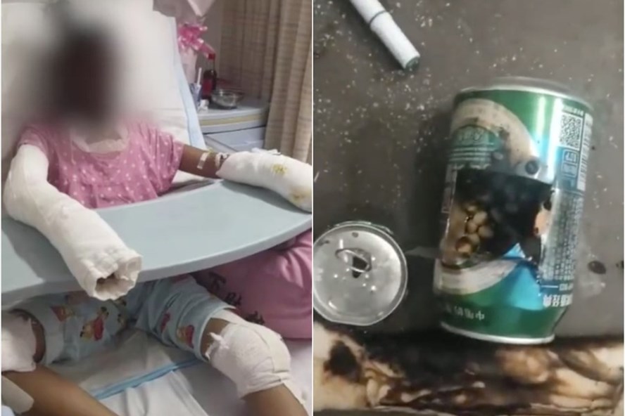 Học video mạng, người phụ nữ bị ngộ độc nặng sau khi gội đầu bằng thuốc trừ sâu