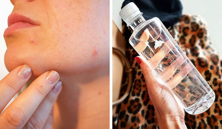 Hoóc-môn này phá vỡ các sợi collagen và làm cho da bị bong tróc. Hoóc-môn này phá vỡ các sợi collagen và làm cho da bị bong tróc.
