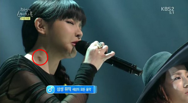 Ai cũng nghĩ Park Bom phát tướng do dao kéo nào ngờ nguyên nhân thật sự là do căn bệnh này 