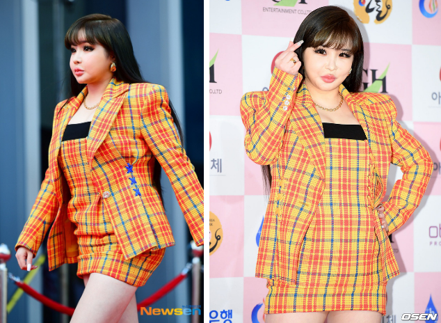 Ai cũng nghĩ Park Bom phát tướng do dao kéo nào ngờ nguyên nhân thật sự là do căn bệnh này 