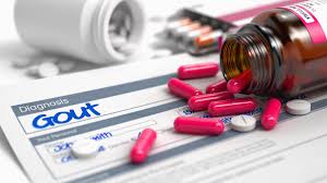 Allopurinol- “vũ khí” trong điều trị bệnh gout và những lưu ý nhất định, người dùng cần nắm rõ