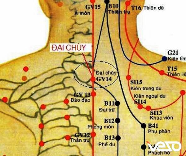 Bam-huyet-dieu-tri-gan-nhiem-mo