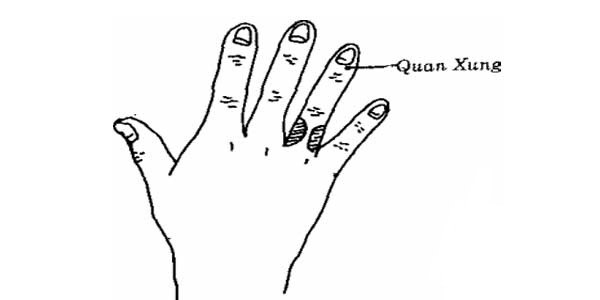 Bam-huyet-dieu-tri-gan-nhiem-mo