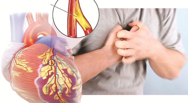 Bệnh viện Việt Đức khám và tư vấn miễn phí bệnh động mạch vành