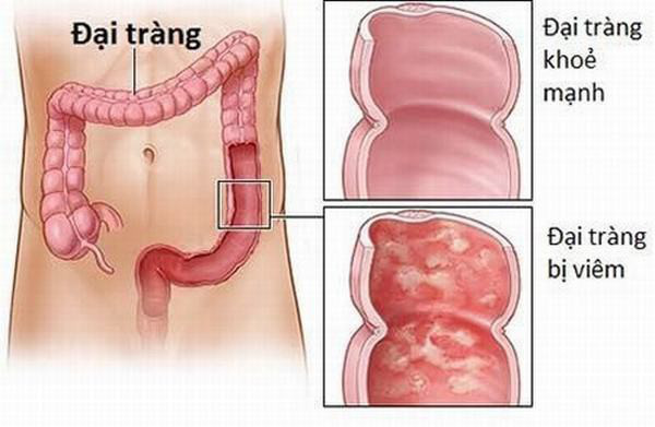 viem dai trang