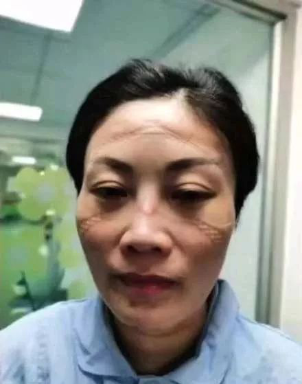 Cảm động nữ y tá không ăn uống, nhịn vệ sinh làm việc suốt 12 tiếng cứu bệnh nhân nhiễm virus coron