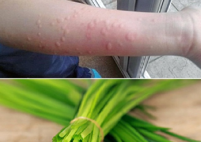 Chữa dị ứng hiệu quả bằng những cây thuốc Nam quanh nhà