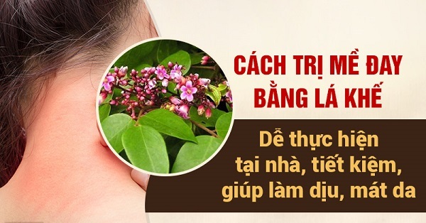 Chữa dị ứng hiệu quả bằng những cây thuốc Nam quanh nhà