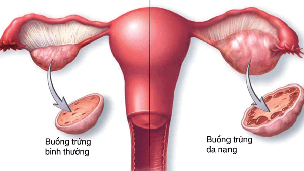 Da-nang-buong-trung