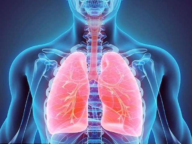 Viêm phổi là bệnh phổ biến trong cuộc sống dấu hiệu bệnh viêm phổi