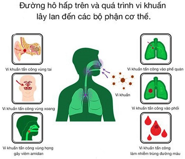 Dong-y-dieu-tri-viem-duong-ho-hap Dong-y-dieu-tri-viem-duong-ho-hap