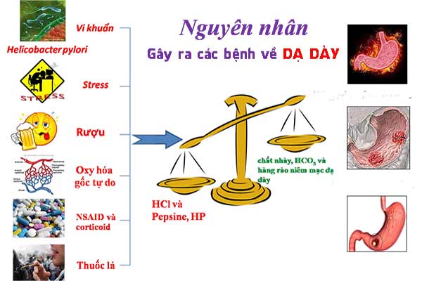  Thói quen ăn uống, sinh hoạt thiếu khoa học là nguyên nhân dẫn đến đau dạ dày