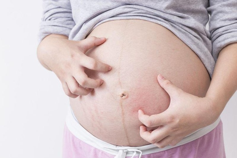 Mẹo chữa ngứa cho bà bầu bằng 5 nguyên liệu cực đơng giản tại nhà Mẹo chữa ngứa cho bà bầu bằng 5 nguyên liệu cực đơng giản tại nhà