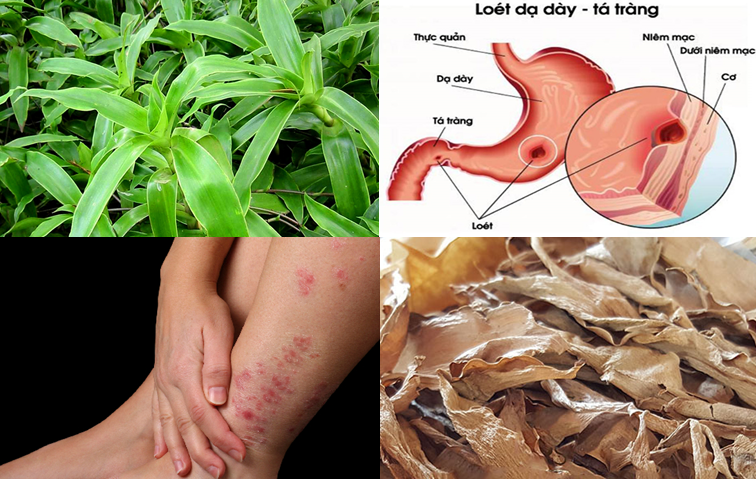 Những bài thuốc chữa bệnh bằng cây lược vàng
