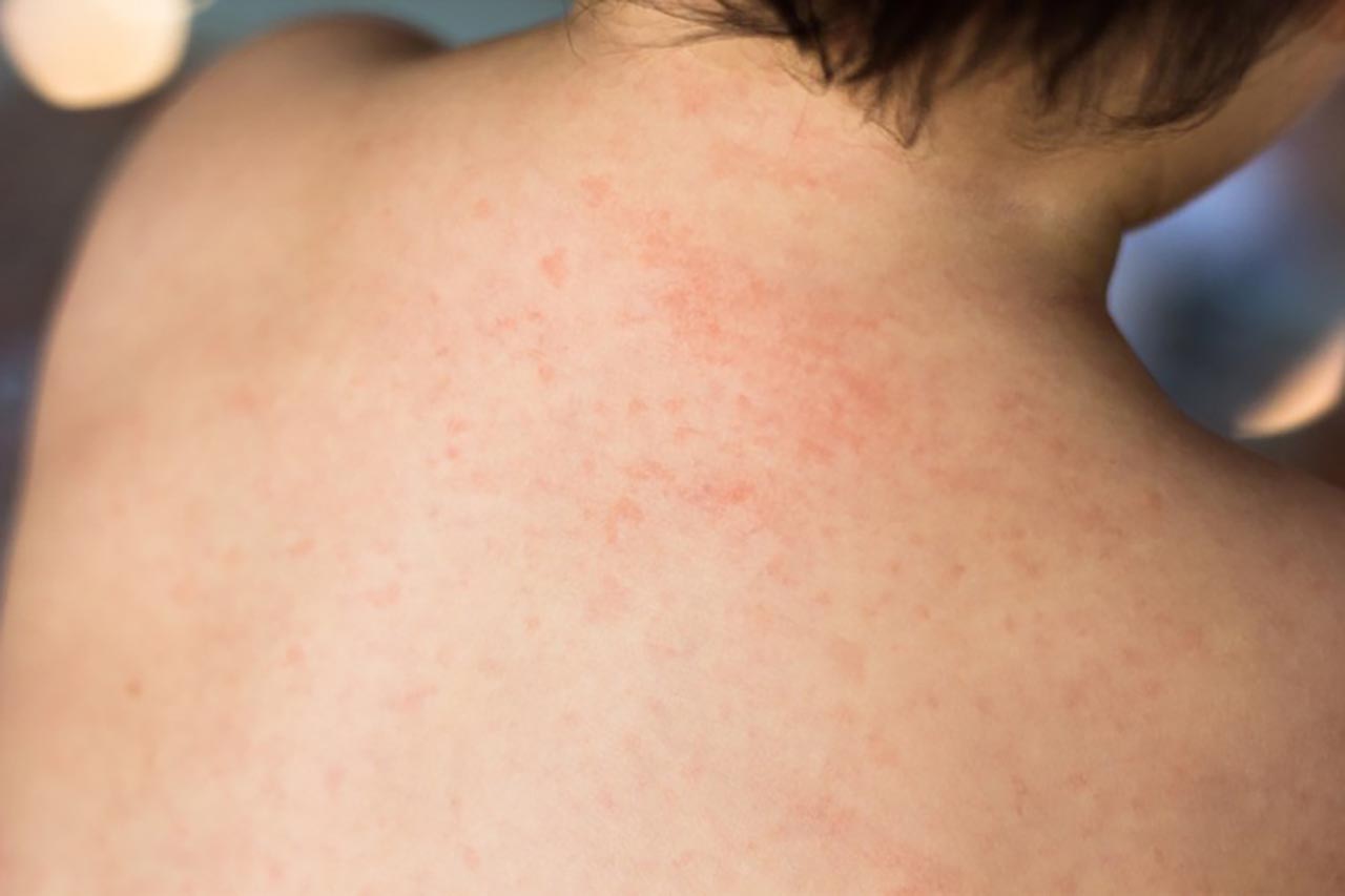 10 triệu chứng bệnh thường gặp cần chú ý