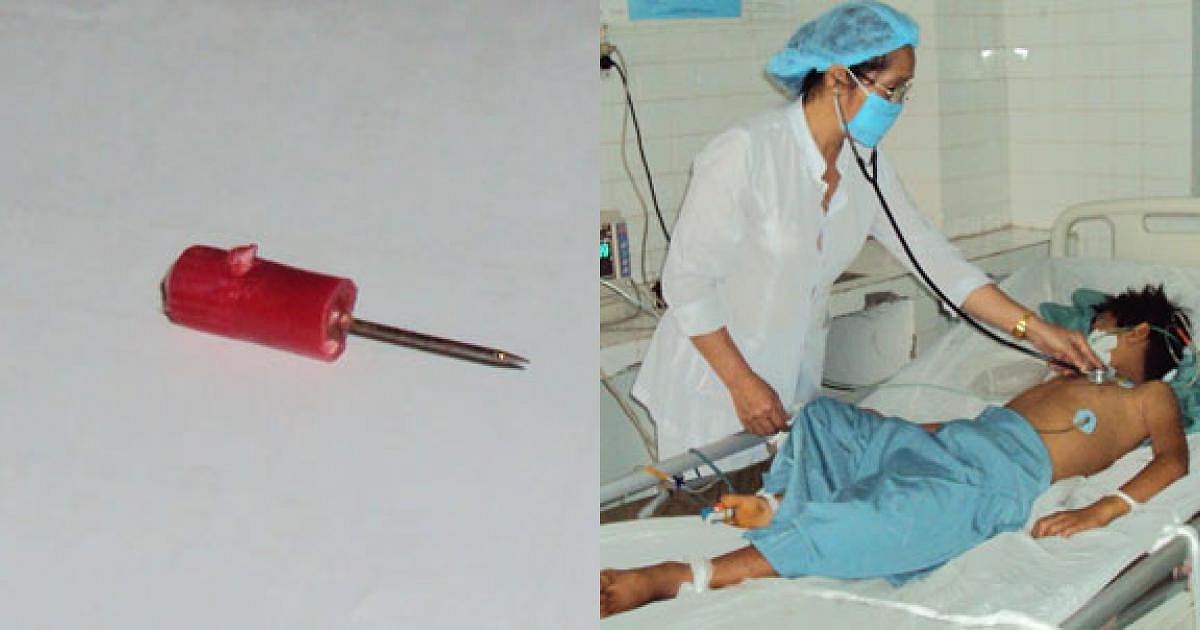 Pha xử lý nhanh trí của người mẹ khi con uống nhầm keo 502 khiến bác sĩ khen ngợi