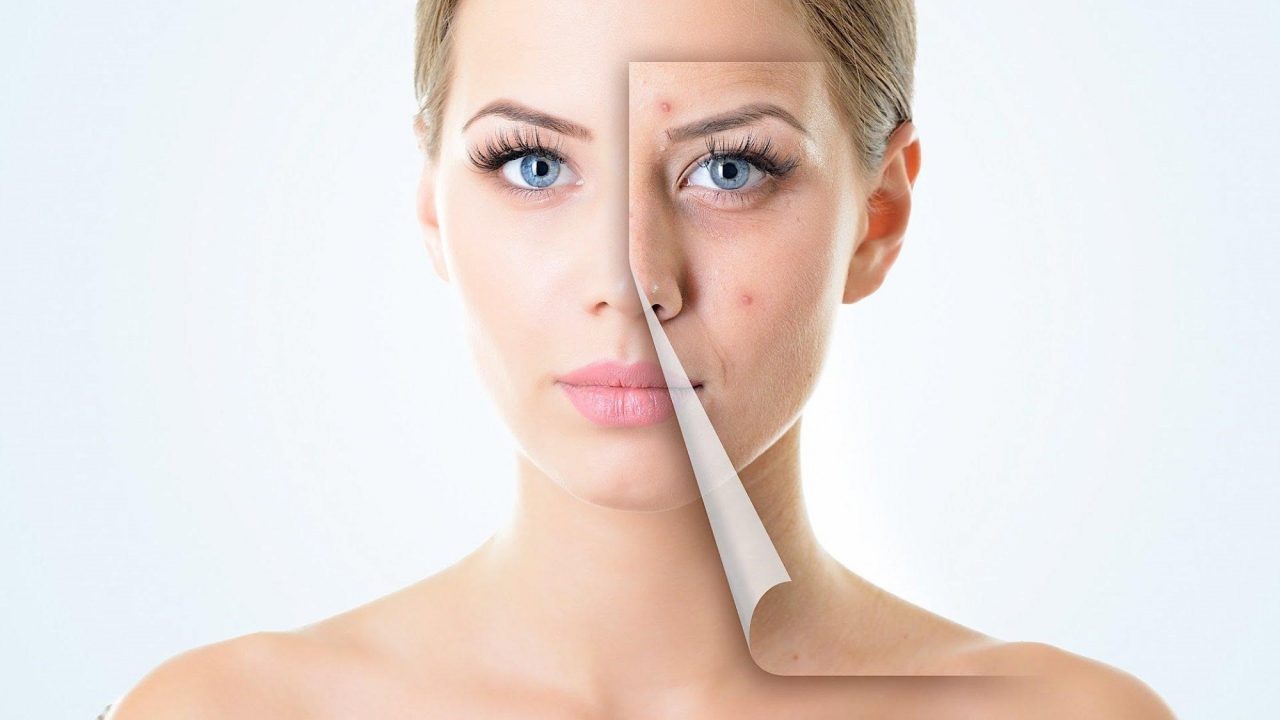 Thuốc Myspa và isotretinoin trị mụn, hiểu đúng và dùng đúng
