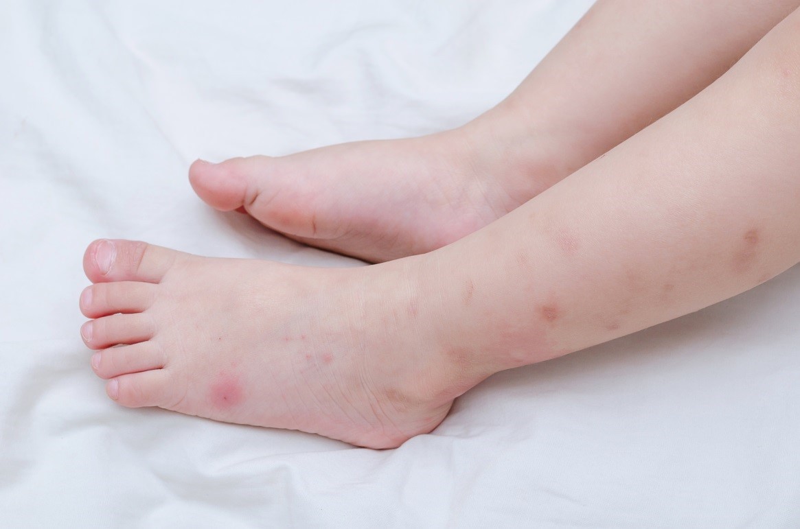 Tiết trời chuyển mùa, phụ huynh nhớ chú ý với 10 triệu chứng cảnh báo bệnh thường gặp ở trẻ