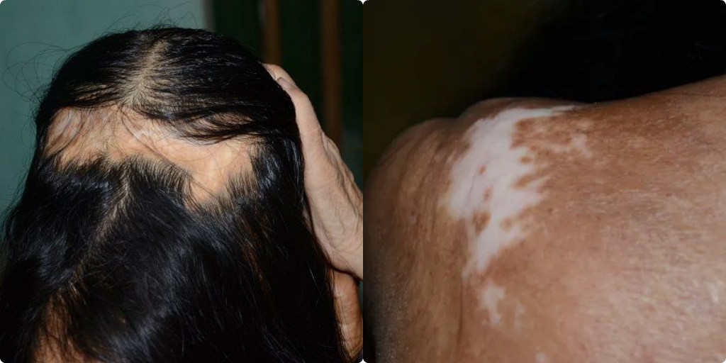 Cảnh đời éo le của người phụ nữ 50 năm không ngậm được miệng, không thể ngoái cổ