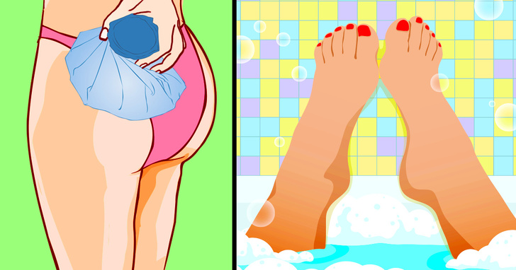 Giảm đau thần kinh tọa tại nhà bằng những bài tập vô cùng đơn giản