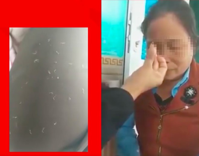 Bác sĩ nói gì về phương pháp bắt sâu trị viêm xoang đang gây sốt tại Phú Thọ chữa viêm xoang