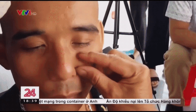 Bác sĩ nói gì về phương pháp bắt sâu trị viêm xoang đang gây sốt tại Phú Thọ chữa viêm xoang
