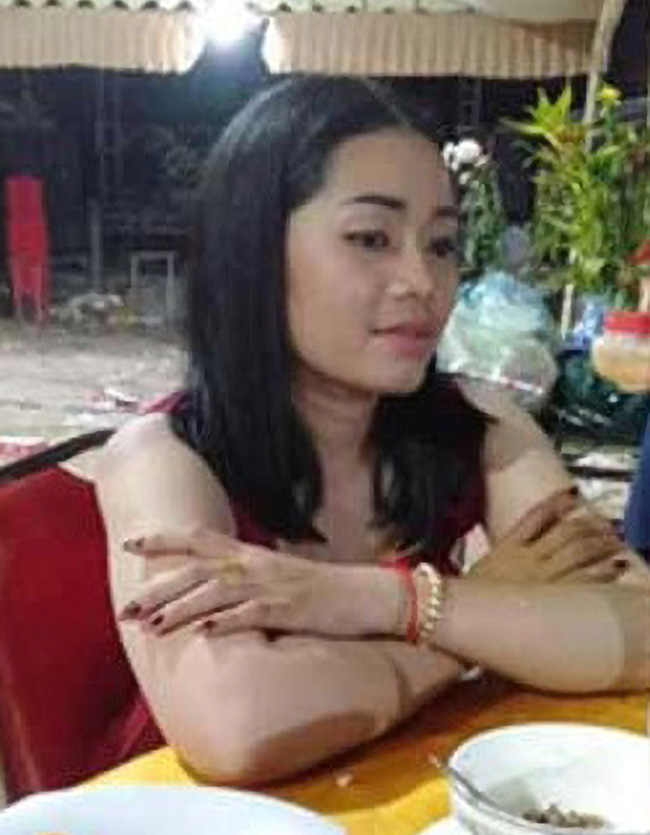 Bị bạn trai tạt axit, chém đứt tay vì dám nói lời chia tay Bị bạn trai tạt axit, chém đứt tay vì dám nói lời chia tay