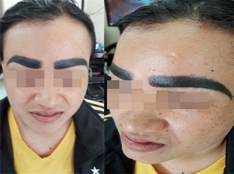 Hậu quả khôn lường khi thẩm mỹ phun xăm chân mày Hậu quả khôn lường khi thẩm mỹ phun xăm chân mày