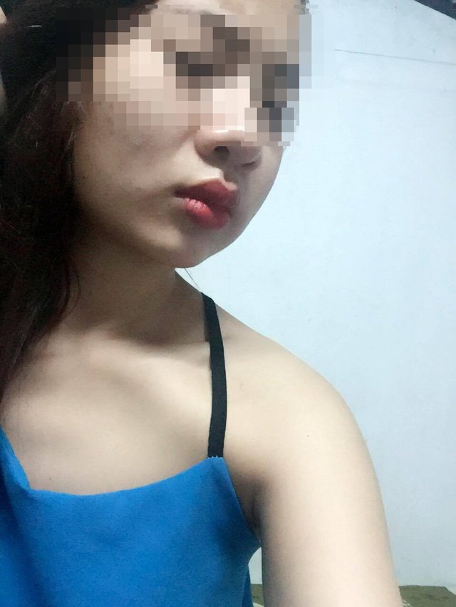 Phẫu thuật má lúm để đổi vận, phúc lộc chưa thấy nhưng họa ngay nhãn tiền