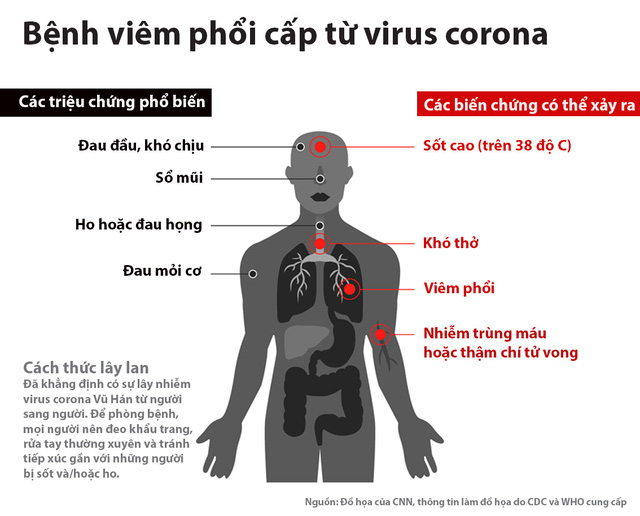  Biểu hiện corona, phân biệt triệu chứng corona với các bệnh thông thường