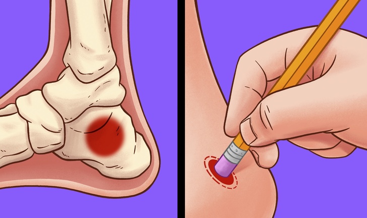 Trị mỏi chân và bàn chân bằng những mẹo đơn giản tại nhà