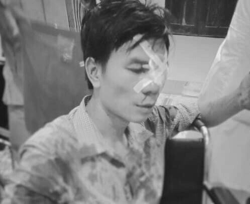 Cán bộ địa chính bị tố đánh người sau va chạm giao thông Cán bộ địa chính bị tố đánh người sau va chạm giao thông