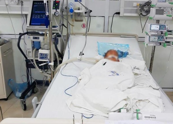Cha mẹ mua cồn về sát khuẩn tay, con nghịch gây bỏng nặng Cha mẹ mua cồn về sát khuẩn tay, con nghịch gây bỏng nặng