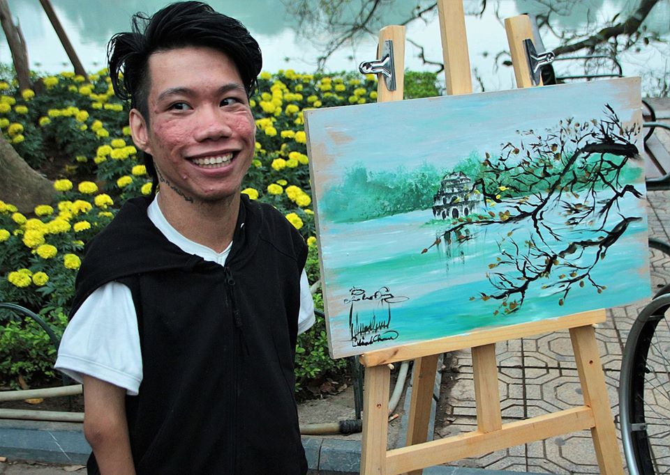 Chàng họa sĩ khuyết tật truyền cảm hứng hàng triệu người nhờ tài năng và nghị lực phi thường Chàng họa sĩ khuyết tật truyền cảm hứng hàng triệu người nhờ tài năng và nghị lực phi thường