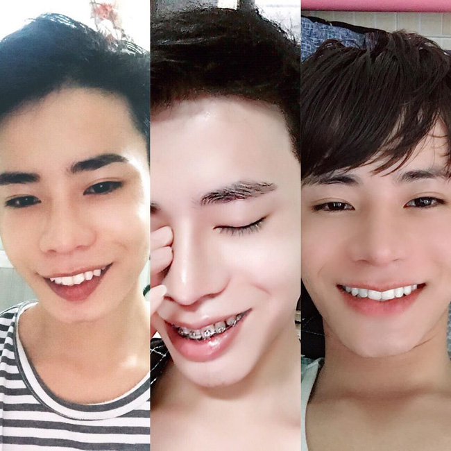 Chàng trai Hà Tĩnh 4 lần giấu gia đình phẫu thuật thẩm mỹ Chàng trai Hà Tĩnh 4 lần giấu gia đình phẫu thuật thẩm mỹ