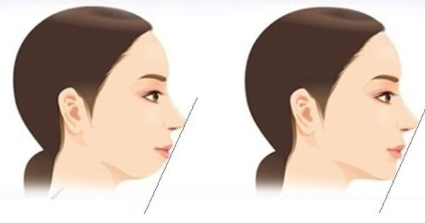 Có 5 đặc điểm này trên mặt thì dù cố đến mấy vẫn nghèo kiết xác, cả đời lận đận long đong