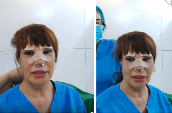 Cô dâu 62 tuổi gương mặt biến dạng sau phẫu thuật thẩm mỹ