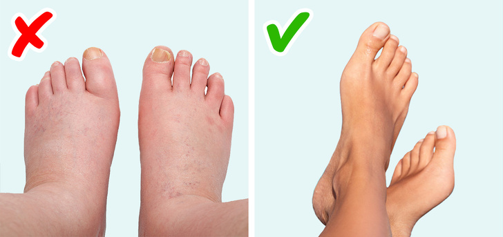 Dấu hiệu bất thường cảnh báo vấn đề sức khỏe: 1 trên mặt, 3 trên chân tay và 5 cảm giác lạ Dấu hiệu bất thường cảnh báo vấn đề sức khỏe: 1 trên mặt, 3 trên chân tay và 5 cảm giác lạ