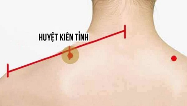 Bam-huyet-chua-benh