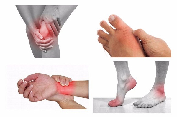 Điều trị viêm khớp dạng thấp khớp từ bài thuốc nam người DaoĐiều trị viêm khớp dạng thấp khớp từ bài thuốc nam người Dao