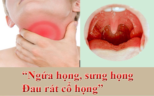 Dong-Y-thuc-hanh-chua-viem-hong