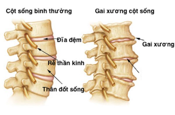 Chua-khoi-gai-doi-dot-cot-song-nho-bai-thuoc-bi-truyen Chua-khoi-gai-doi-dot-cot-song-nho-bai-thuoc-bi-truyen