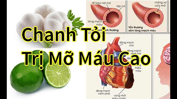 Mon-an-bai-thuoc-chua-mo-mau-cao Mon-an-bai-thuoc-chua-mo-mau-cao