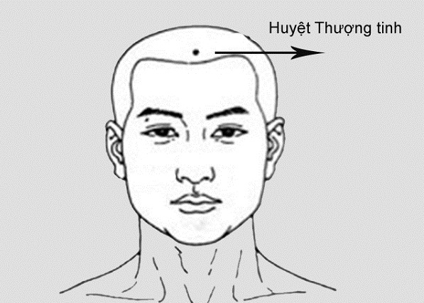 bấm huyệt trị ngạt mũi?bị ngạt mũi bấm những huyệt này