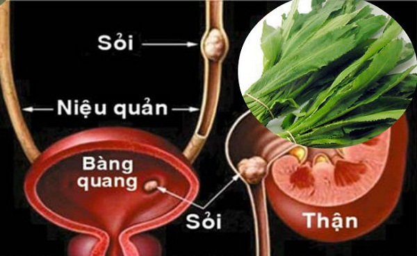 Trị sỏi thận từ lá mùi tàu