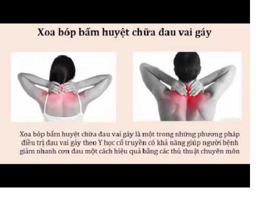 Chữa đau vai gáy bằng xoa bóp - bấm huyệt