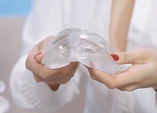Chị em lo bị vỡ túi ngực khi đi máy bay: Bác sĩ lý giải nguyên nhân Chị em lo bị vỡ túi ngực khi đi máy bay: Bác sĩ lý giải nguyên nhân