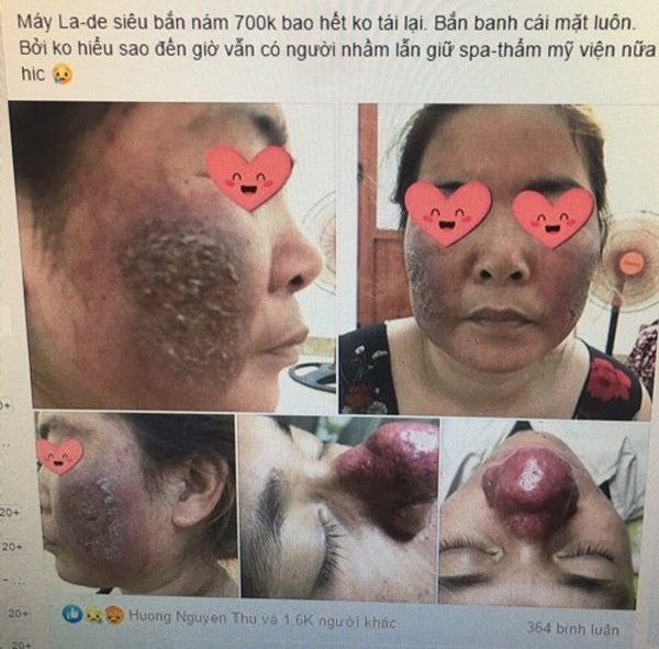 Da hư hỏng nặng sau khi 